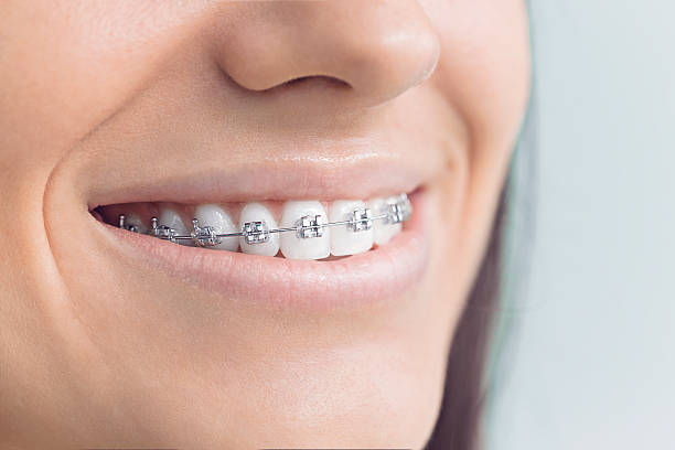 Best Traditional Braces  in Rockwell Place, TX